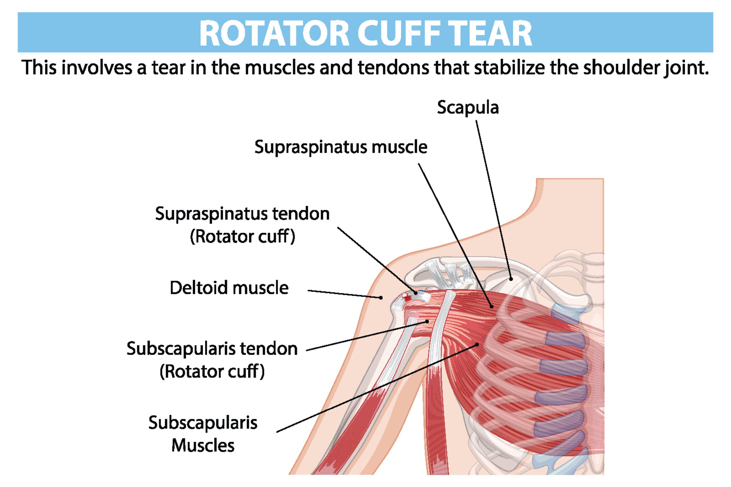 Rotator cuff diagram